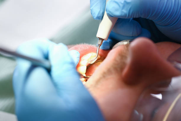 Best Urgent Care for Lost Fillings or Crowns in Williamsburg, PA
